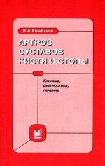 Артроз суставов кисти и стопы клиника, диагностика, лечение.jpeg